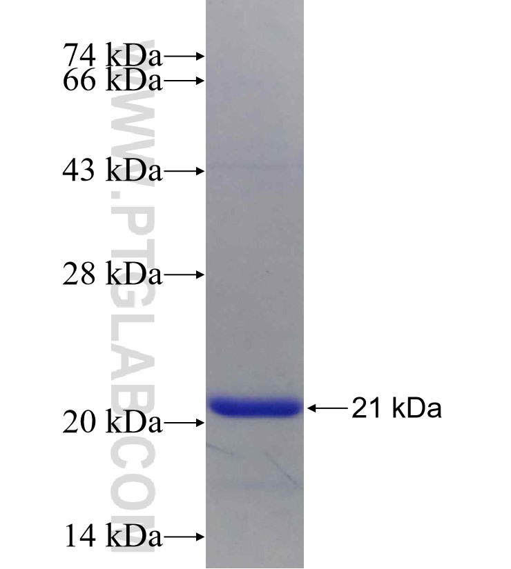 GEMIN6 fusion protein Ag28665 SDS-PAGE