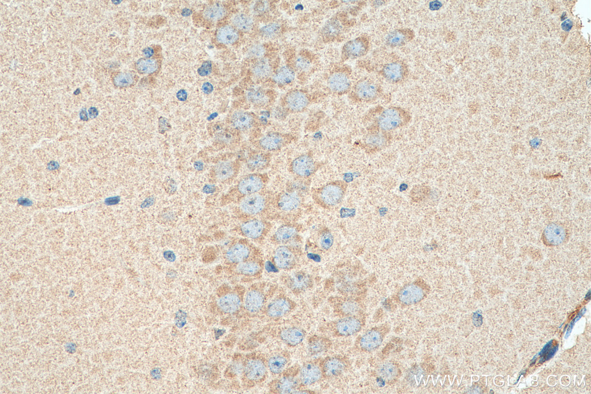 IHC staining of mouse brain using 67871-1-Ig