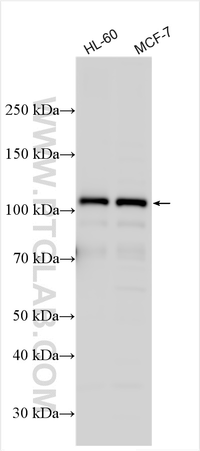 WB analysis using 29617-1-AP