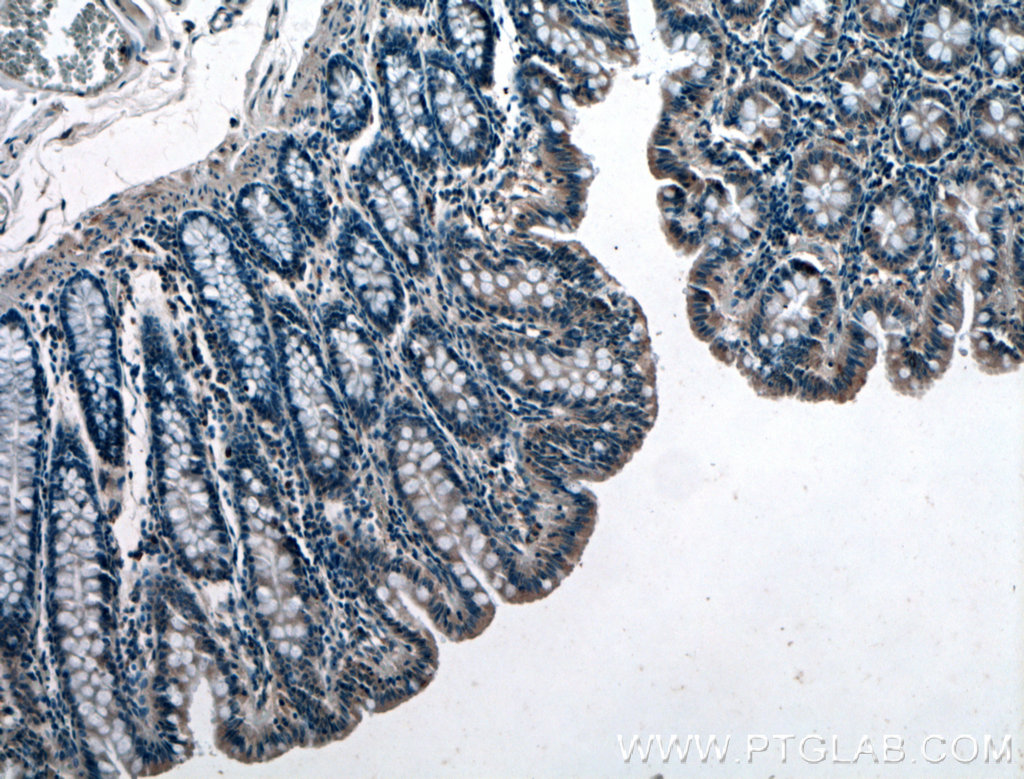 IHC staining of human colon using 27768-1-AP