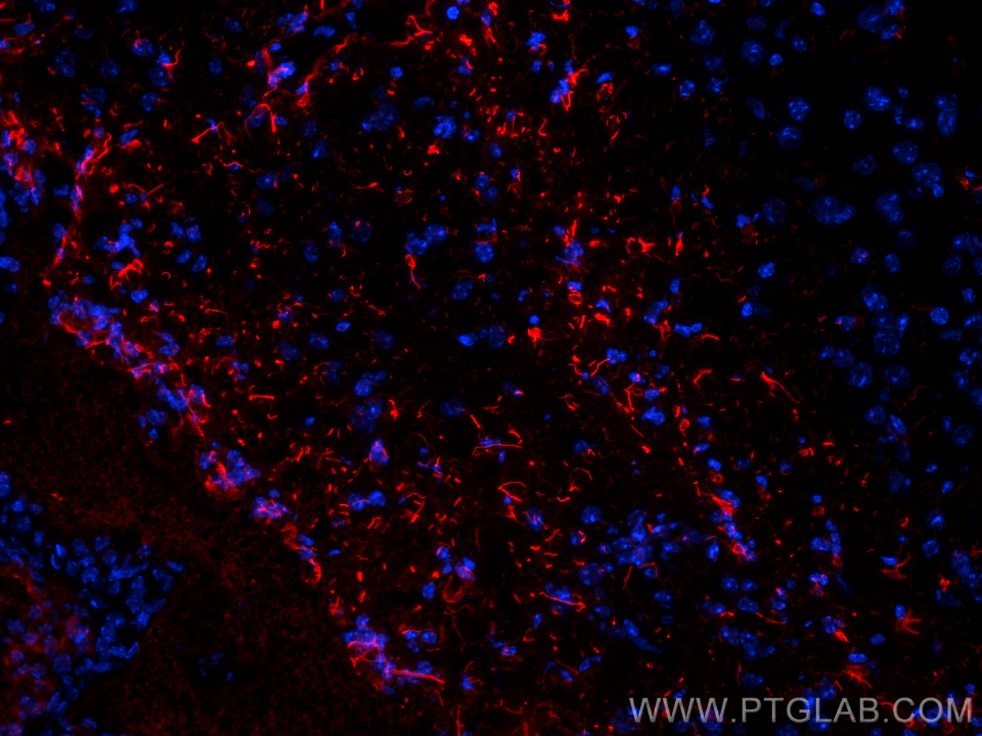 IF Staining of mouse brain using 16825-1-AP