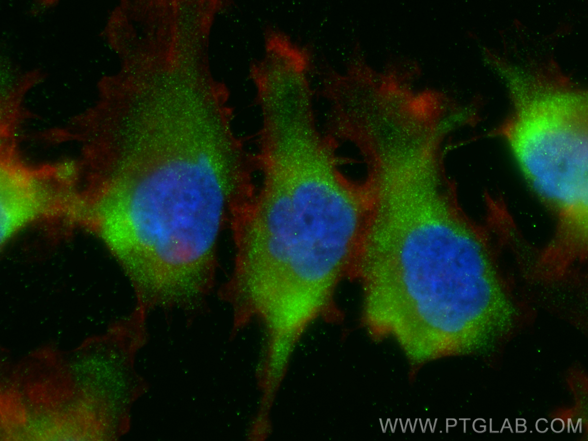 IF Staining of A172 using 16825-1-AP