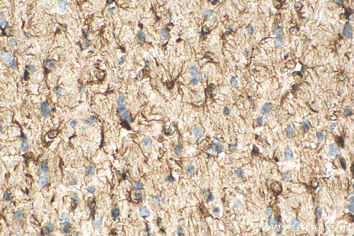 IHC staining of mouse brain using 23935-1-AP
