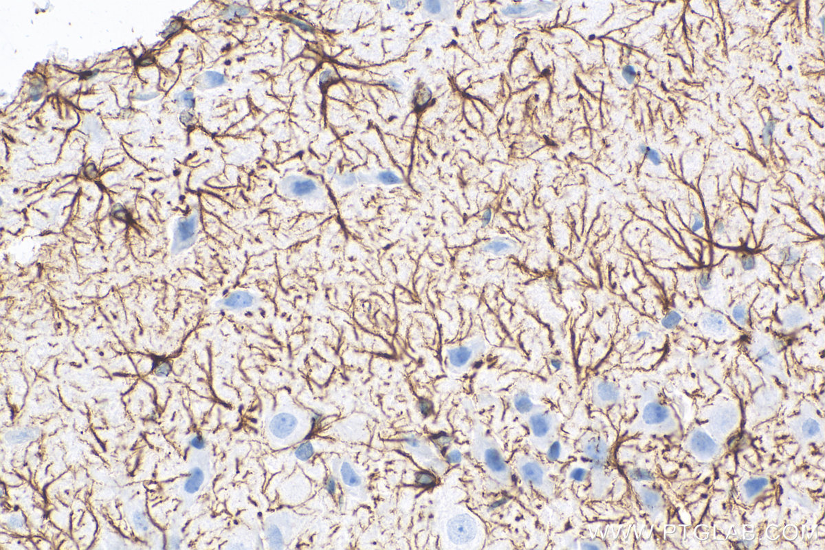 IHC staining of rat brain using 60190-1-Ig