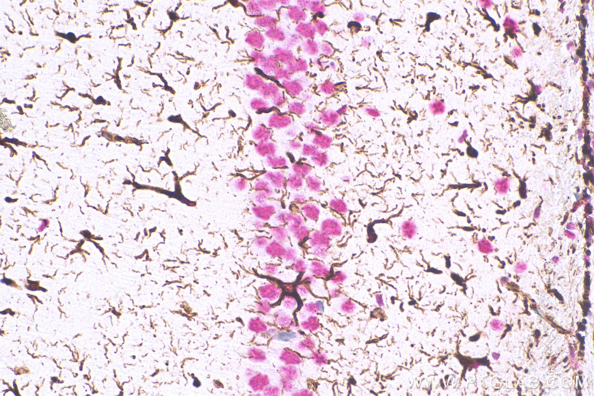 IHC staining of mouse brain using 60190-1-Ig