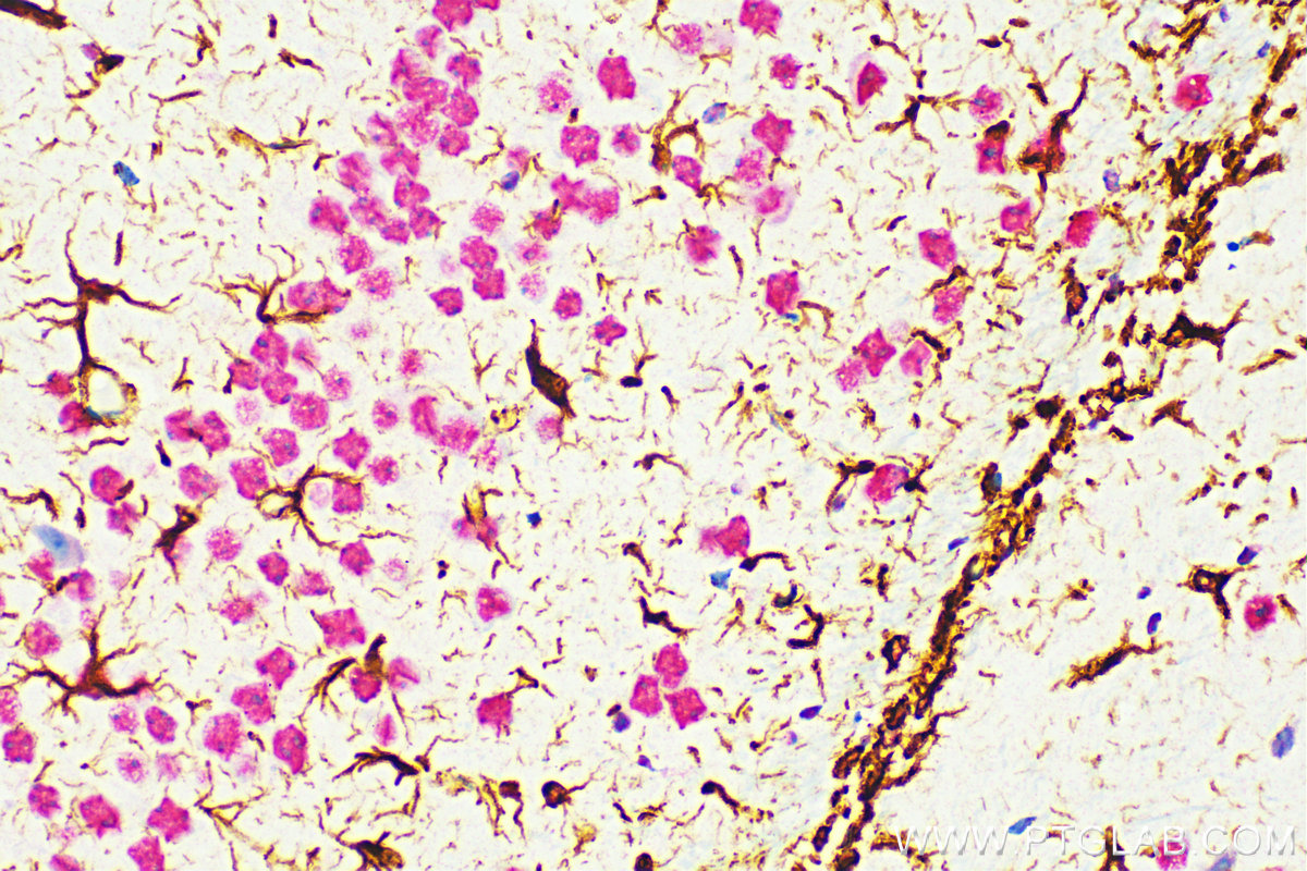 IHC staining of mouse brain using 60190-1-Ig