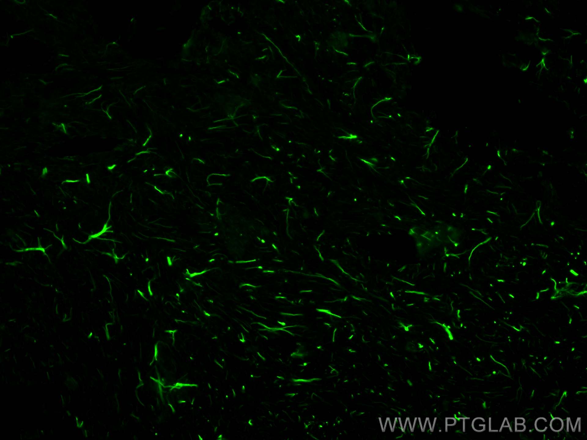 IF Staining of mouse brain using CL488-81063