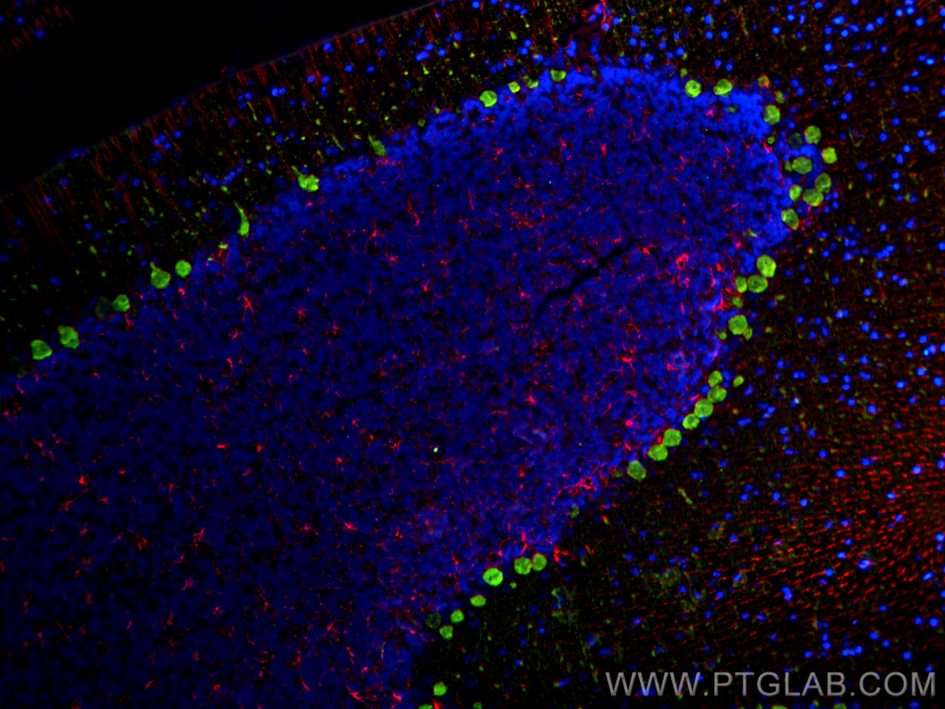 IF Staining of rat cerebellum using CL594-16825