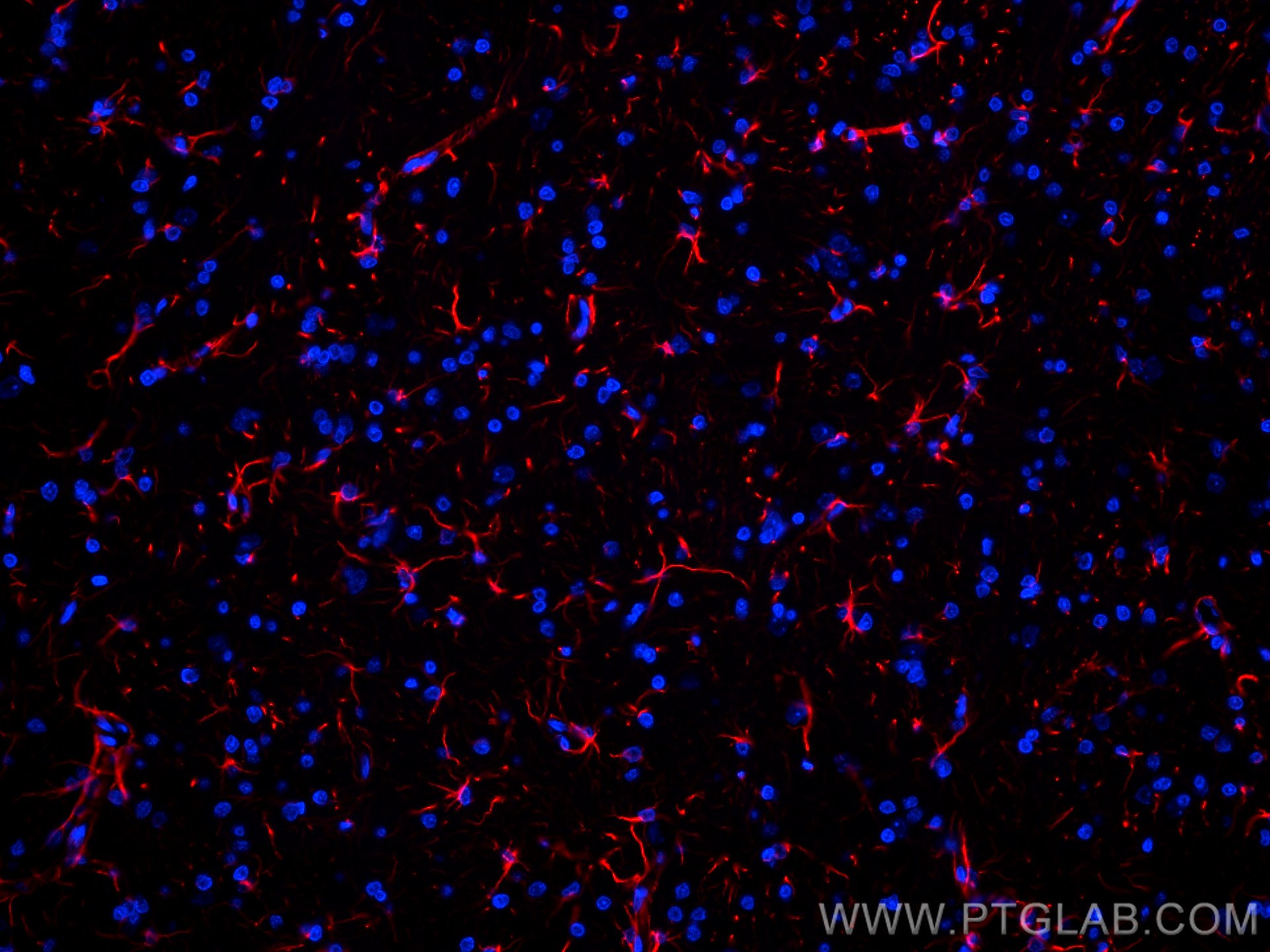 IF Staining of rat brain using CL594-60190