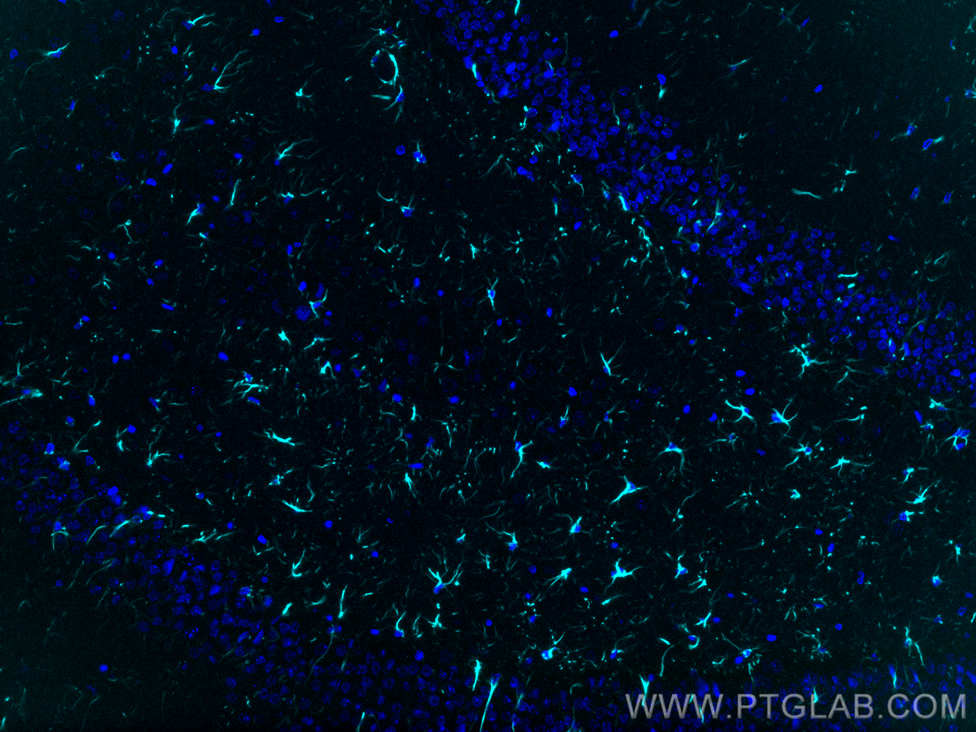 IF Staining of rat brain using CL750-16825