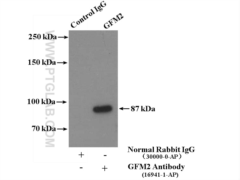 IP experiment of HepG2 using 16941-1-AP