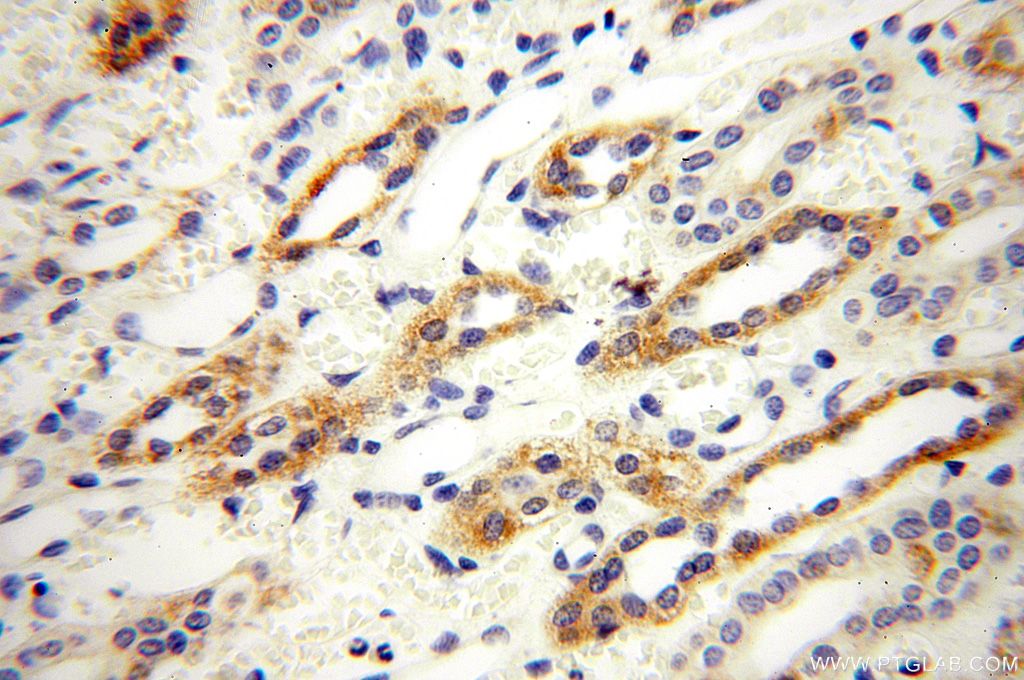 IHC staining of human kidney using 14944-1-AP