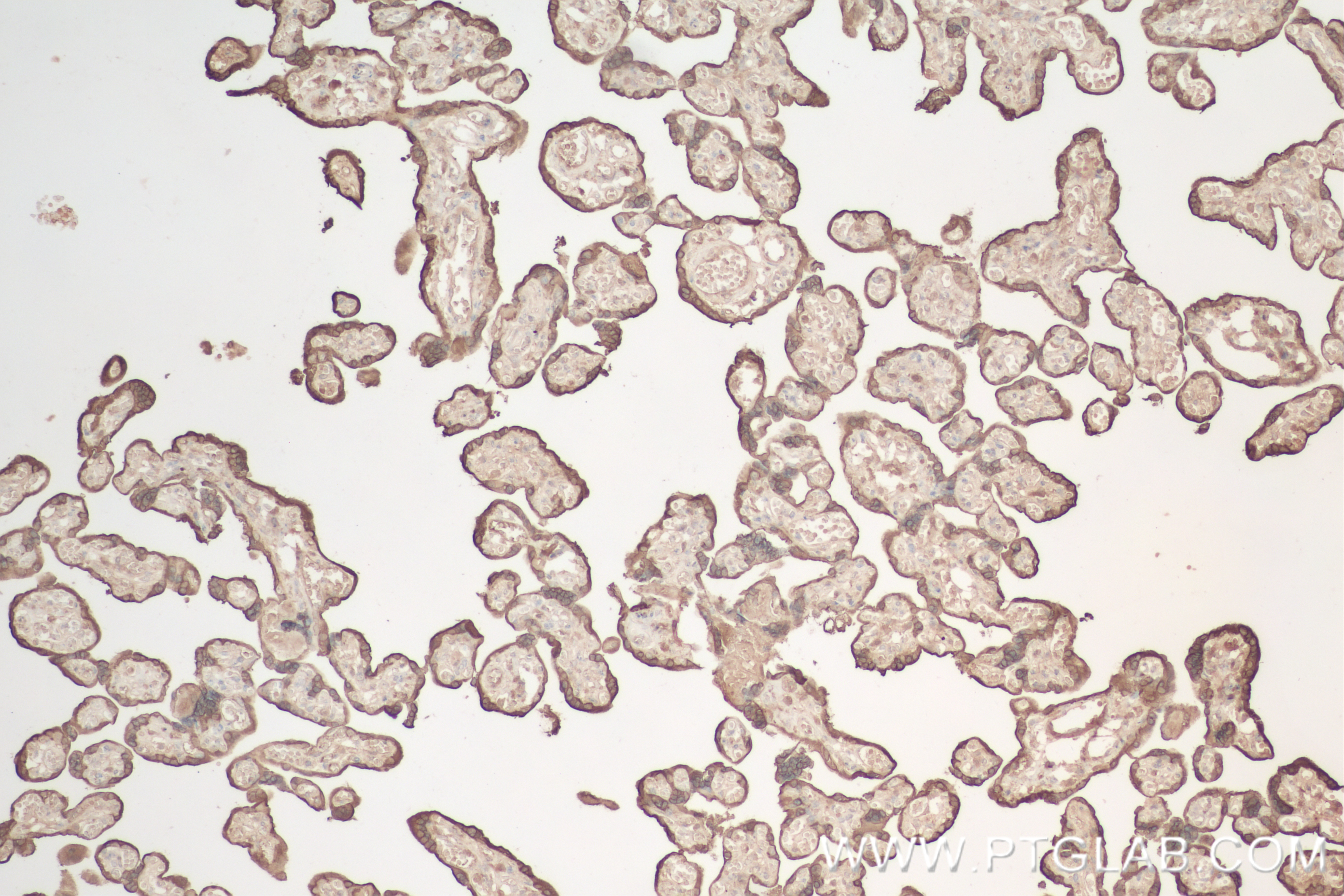 IHC staining of human placenta using 82813-2-RR