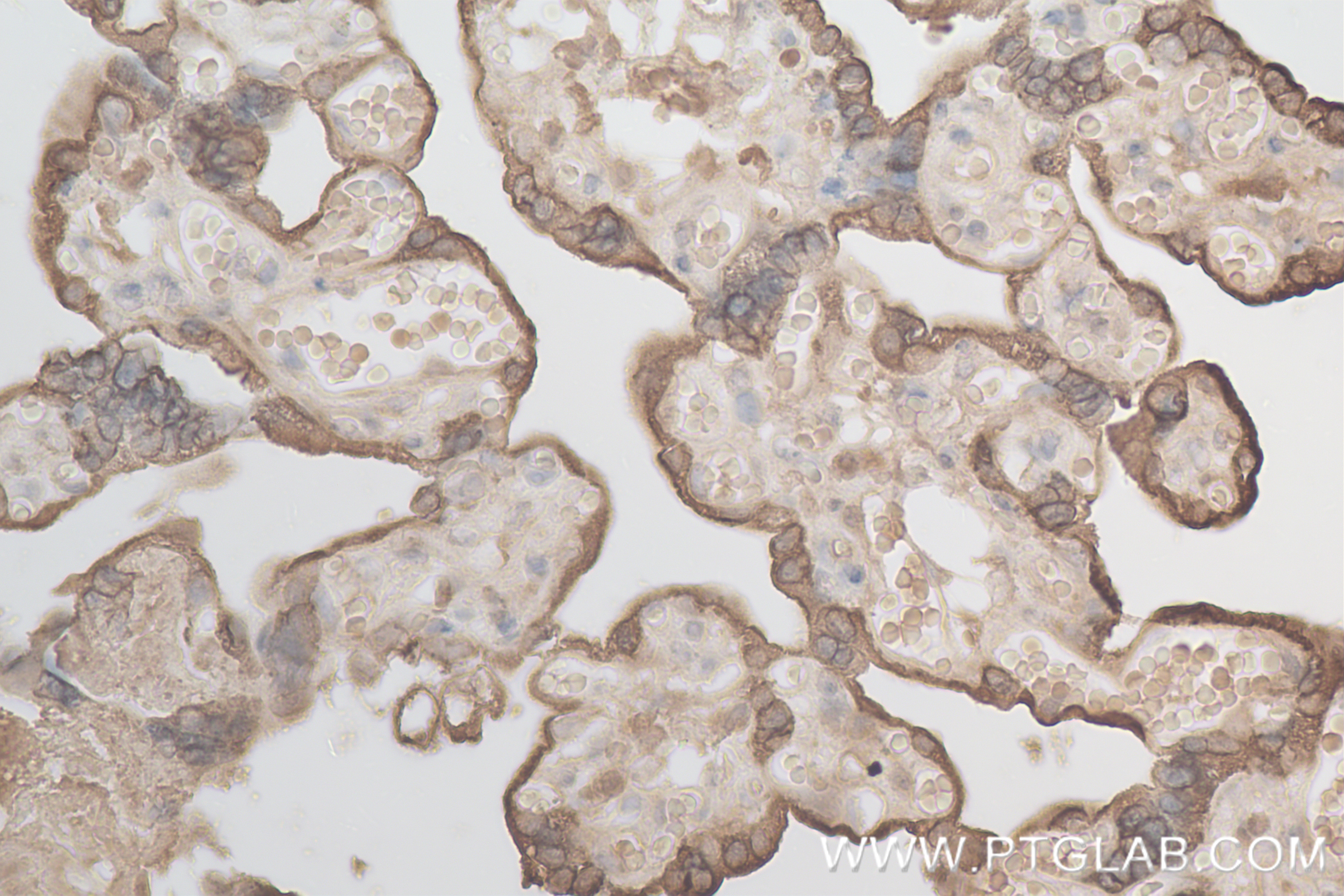 IHC staining of human placenta using 82813-2-RR