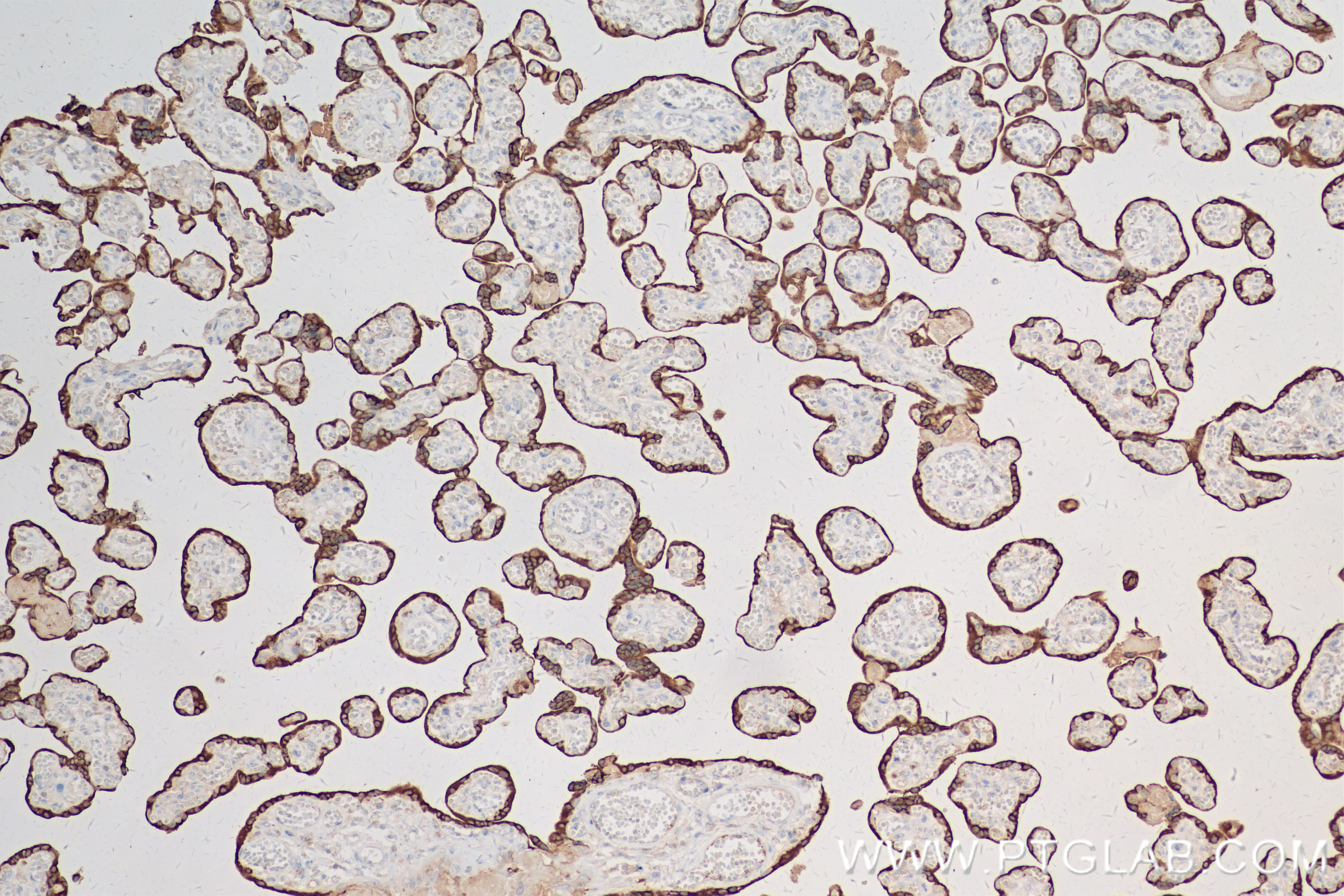 IHC staining of human placenta using 82813-2-RR (same clone as 82813-2-PBS)