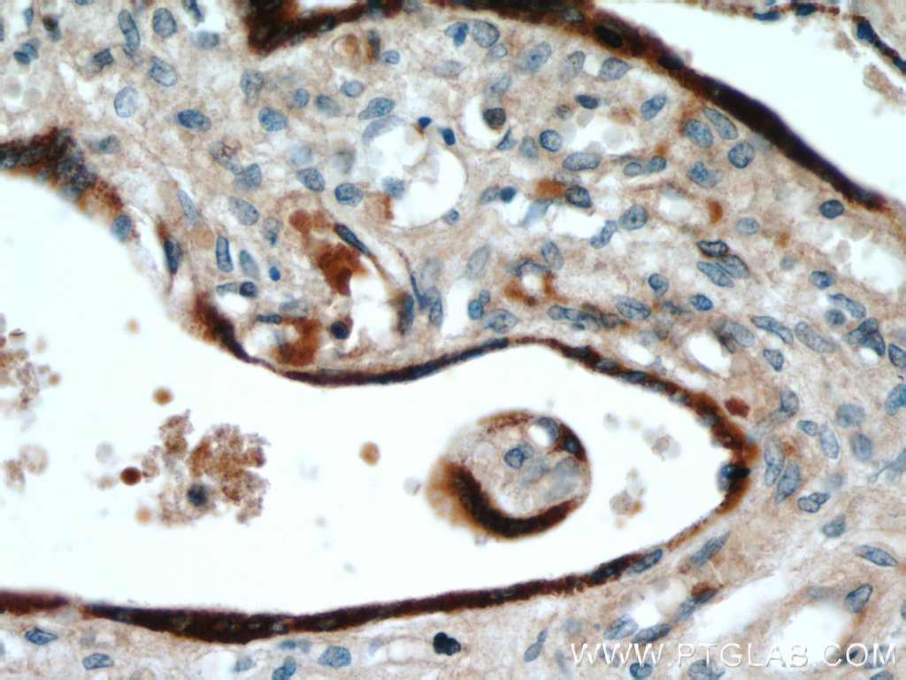 IHC staining of human placenta using 55240-1-AP