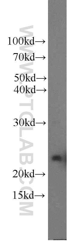 WB analysis of human placenta using 55240-1-AP