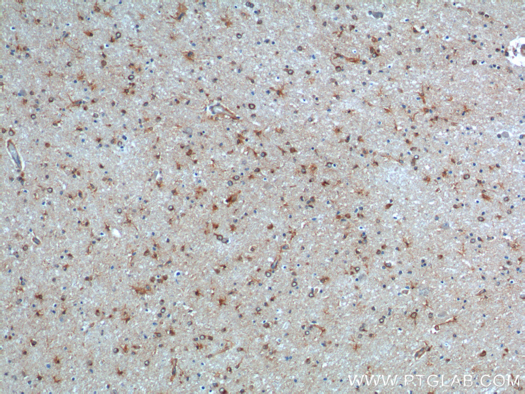 IHC staining of human brain using 26123-1-AP