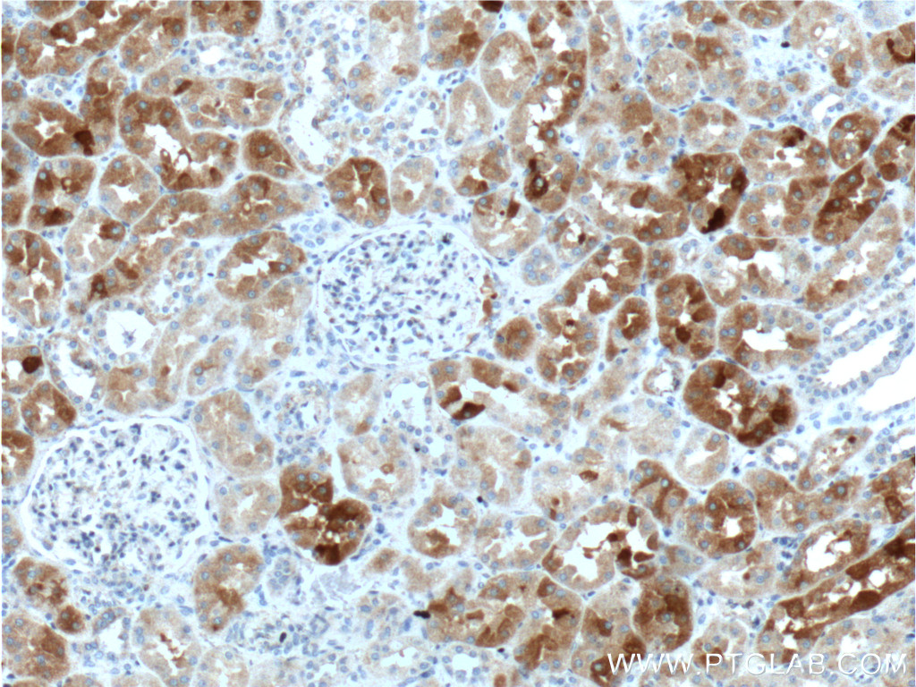 IHC staining of human kidney using 20715-1-AP