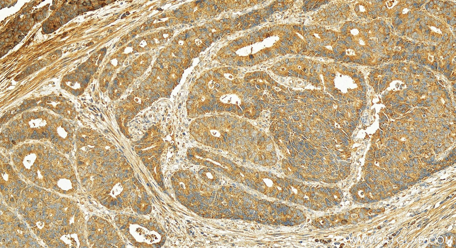 IHC staining of human stomach using 13309-1-AP