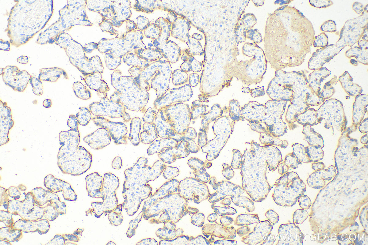 IHC staining of human placenta using 24849-1-AP