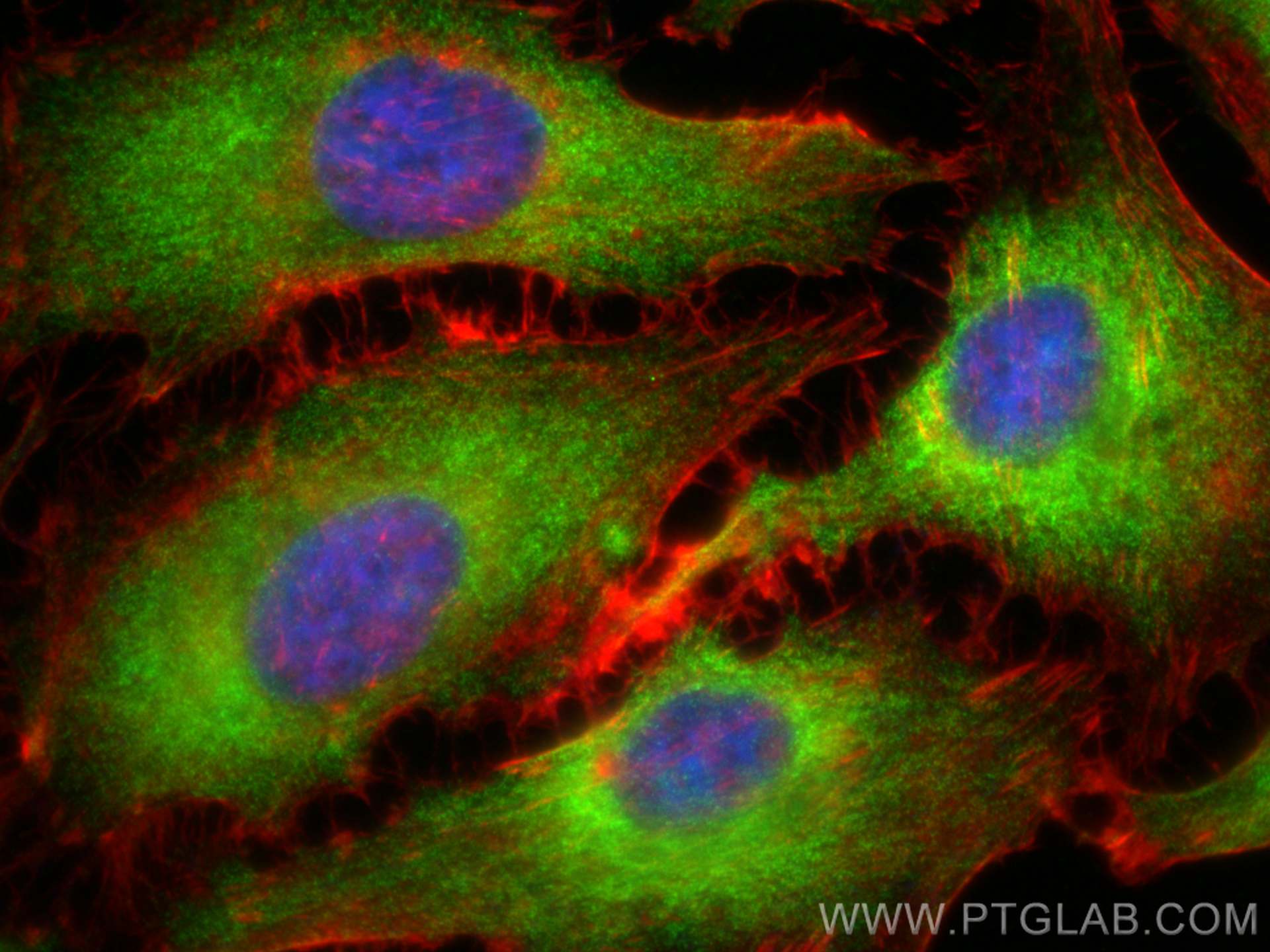 IF Staining of HeLa using 24790-1-AP