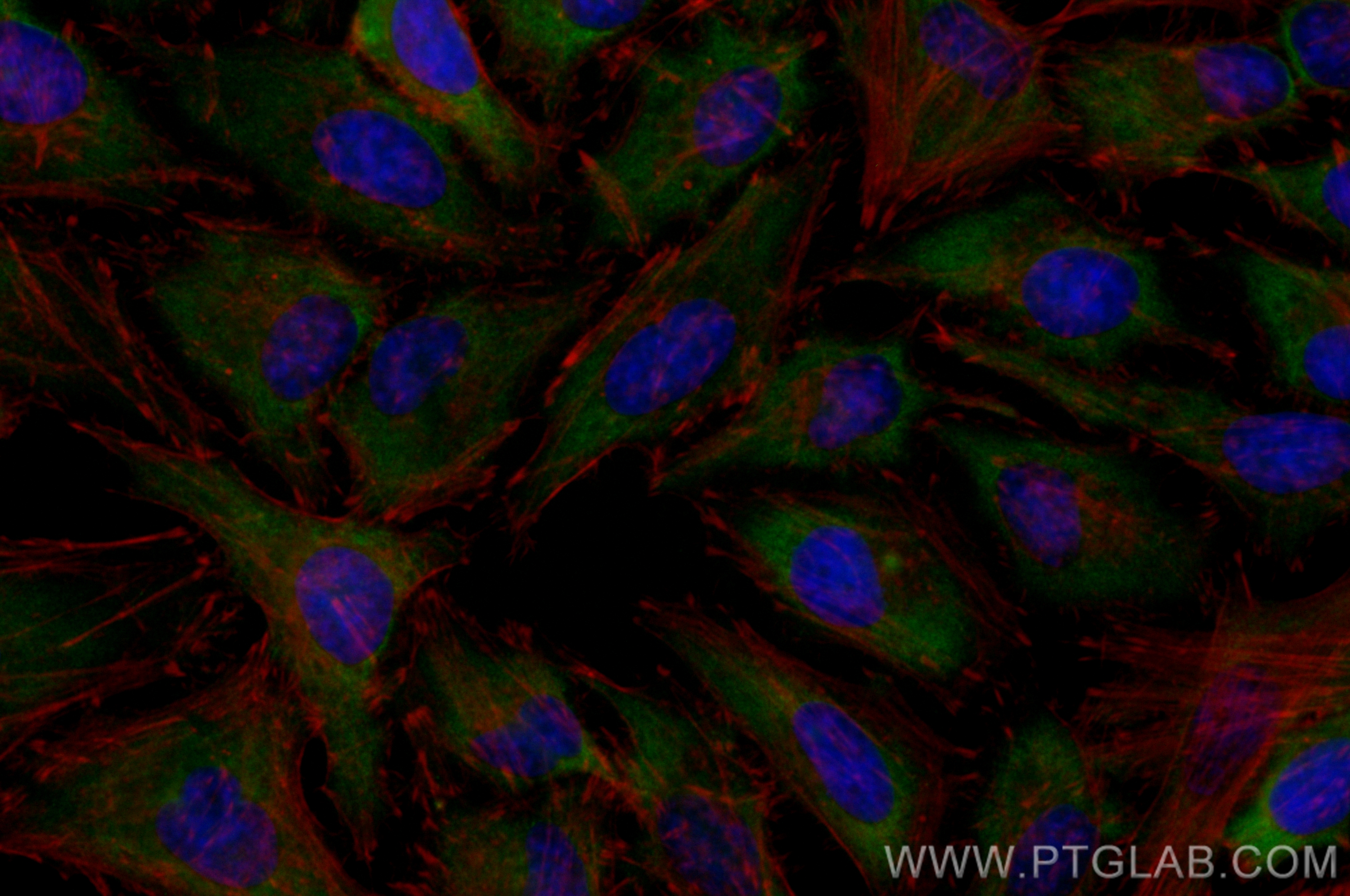 IF Staining of HeLa using CL488-24790