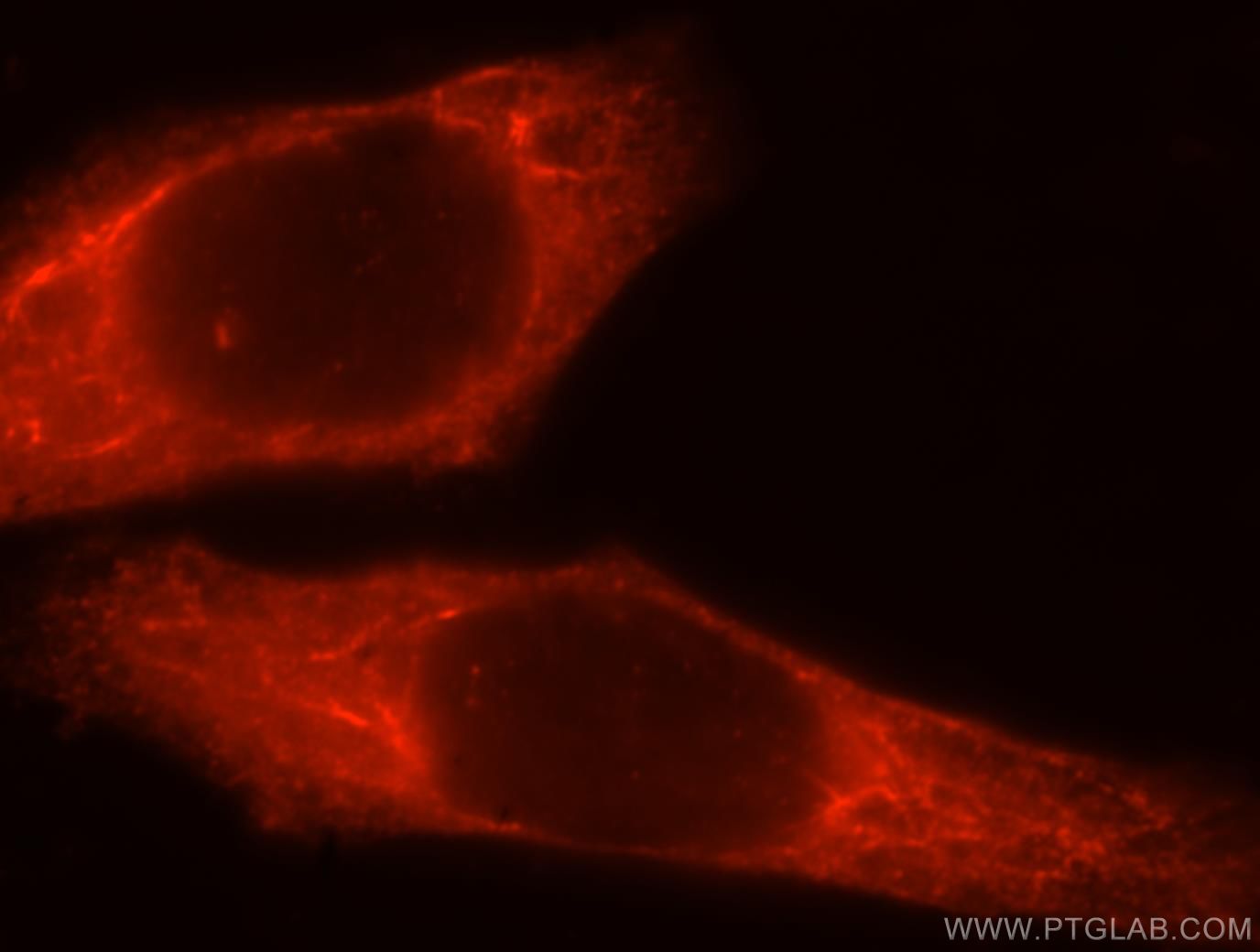 IF Staining of HepG2 using 17293-1-AP