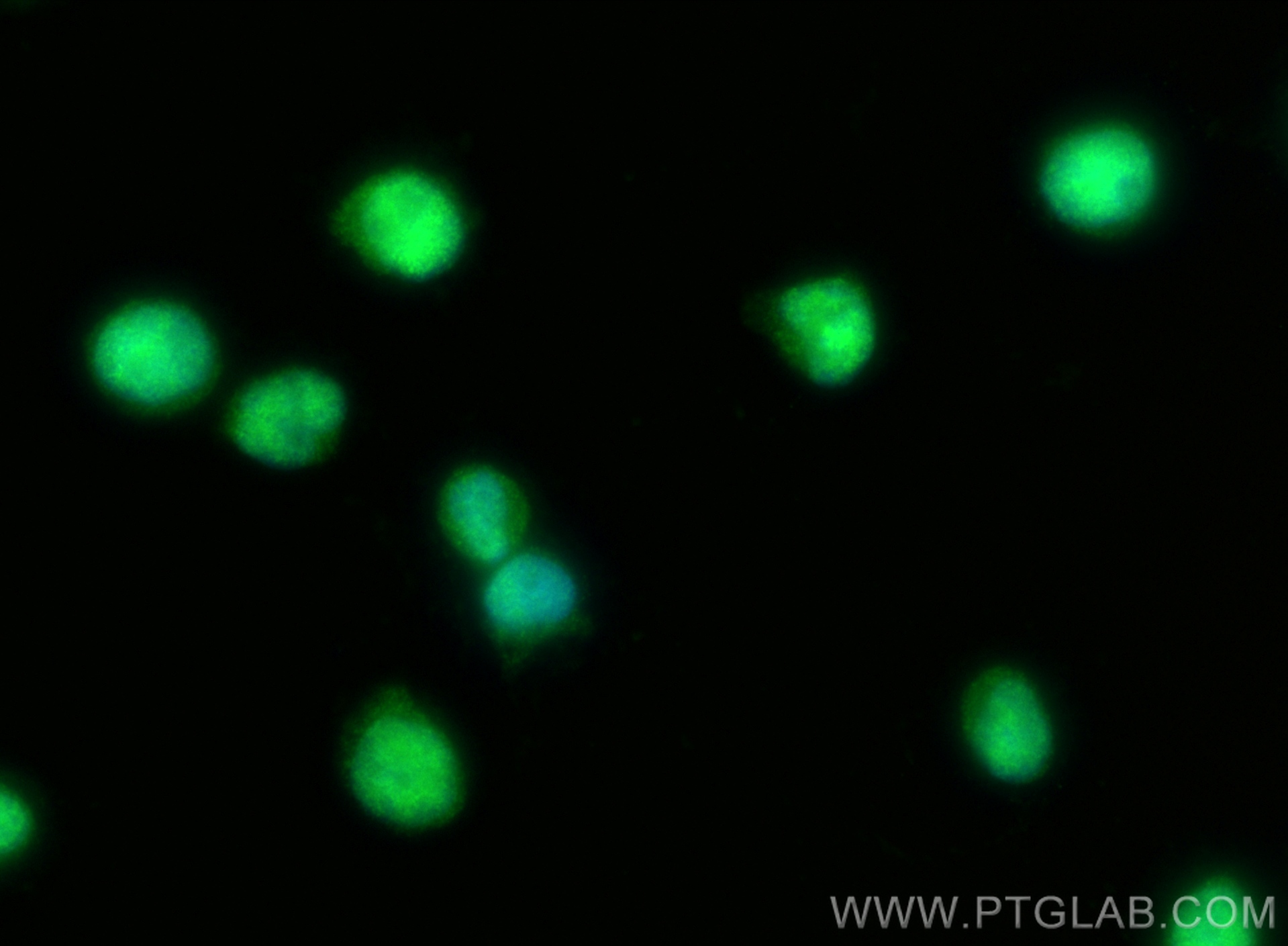 IF Staining of Jurkat using 16247-1-AP