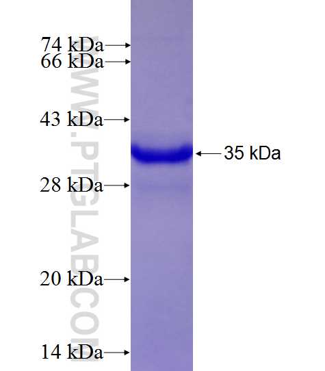 GIT2 fusion protein Ag27616 SDS-PAGE