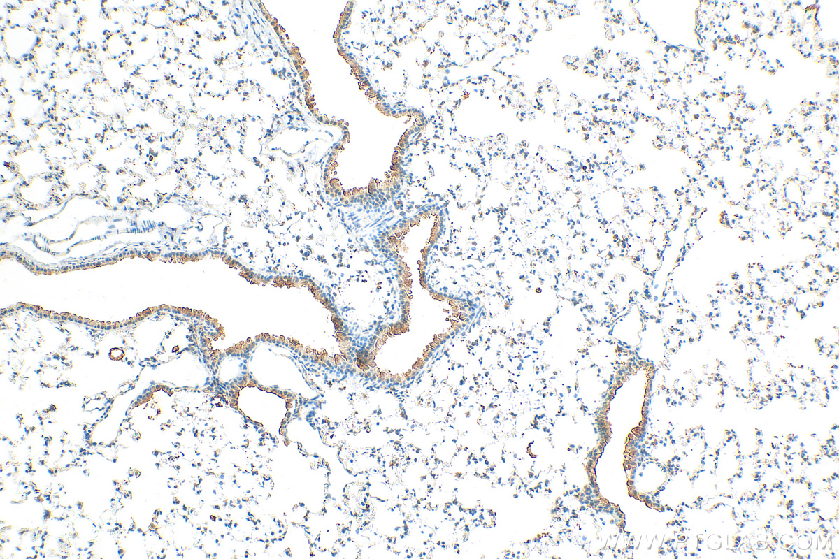 IHC staining of mouse lung using 26602-1-AP