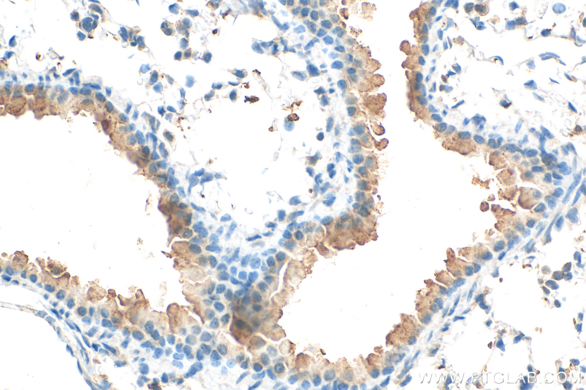 IHC staining of mouse lung using 26602-1-AP