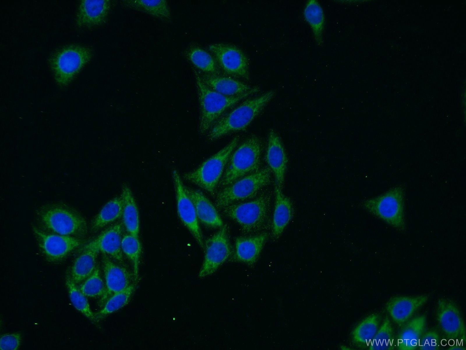 IF Staining of HepG2 using 13360-1-AP