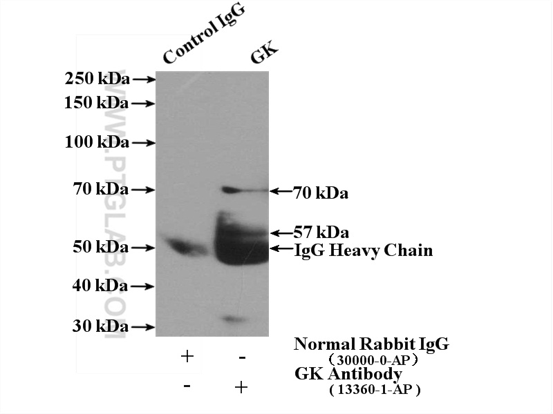 IP experiment of HepG2 using 13360-1-AP