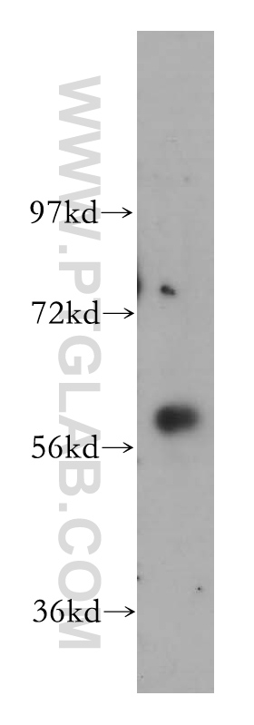 WB analysis of HeLa using 14176-1-AP