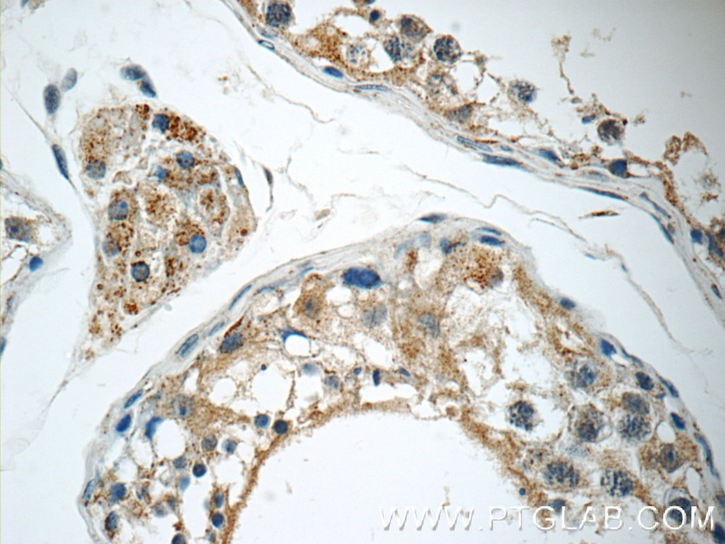 IHC staining of human testis using 11395-1-AP