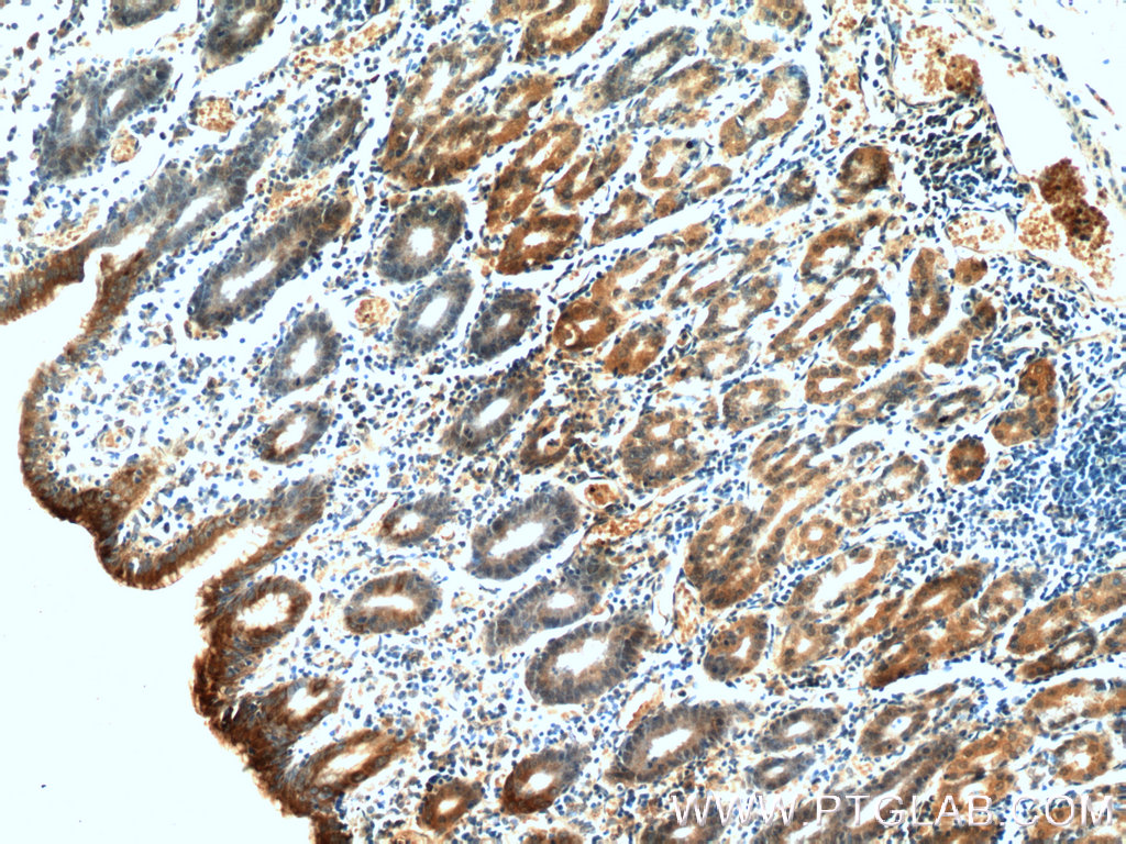 IHC staining of human stomach using 60130-1-Ig (same clone as 60130-1-PBS)