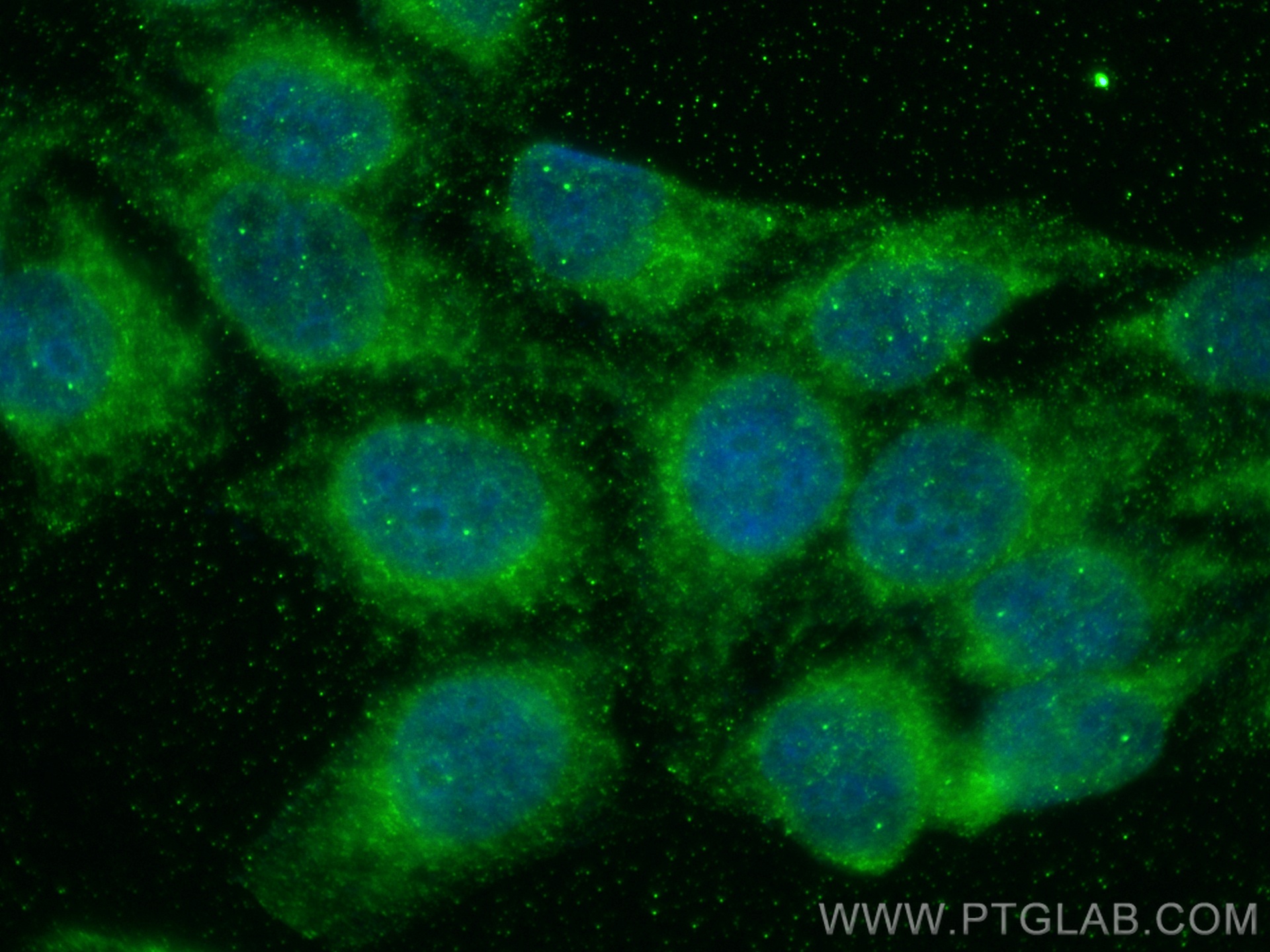 IF Staining of HepG2 using 66121-1-Ig