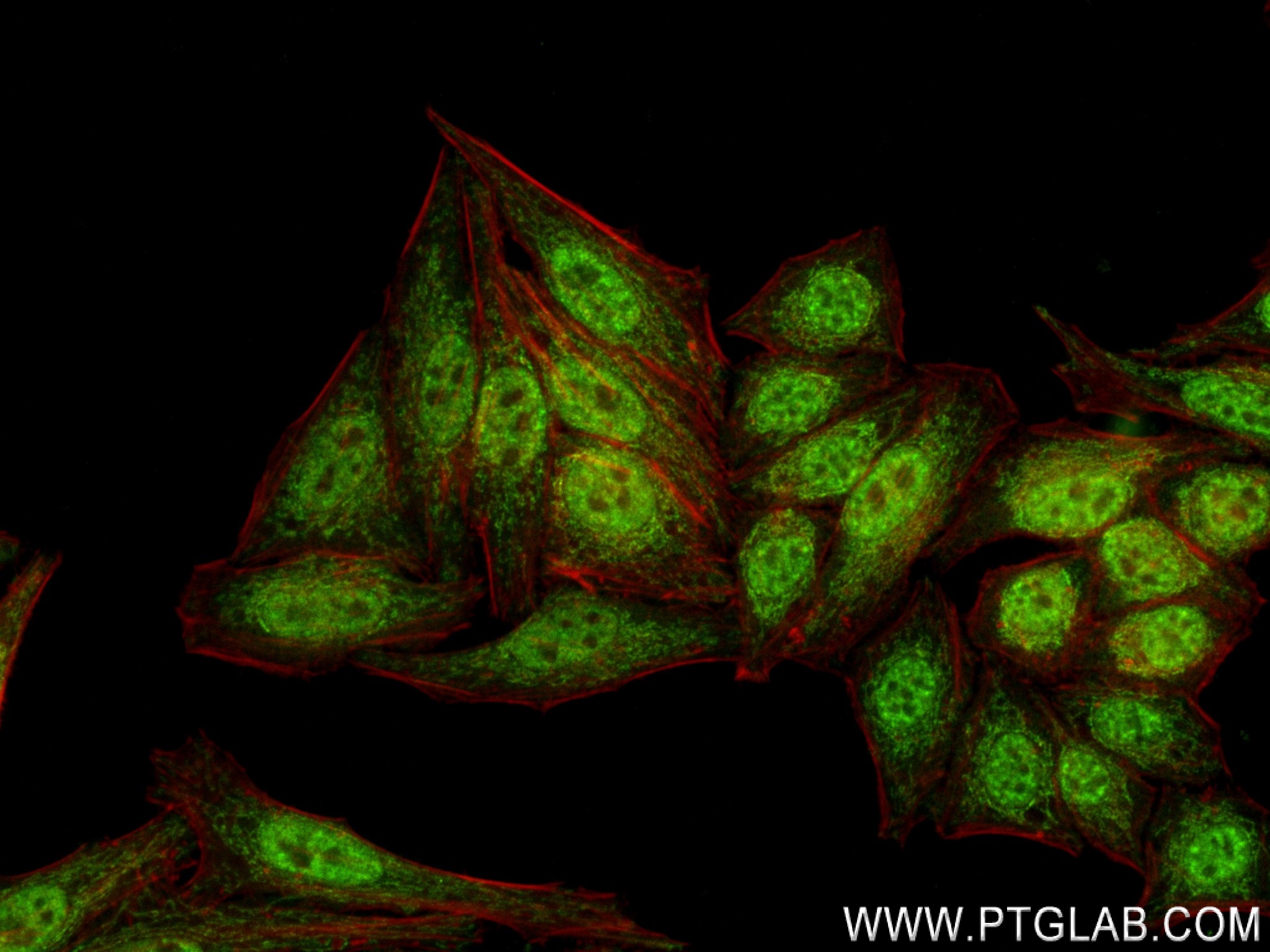 IF Staining of HepG2 using 84141-1-RR