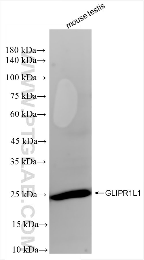 GLIPR1L1