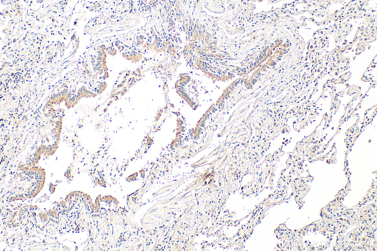 IHC staining of human lung using 16508-1-AP