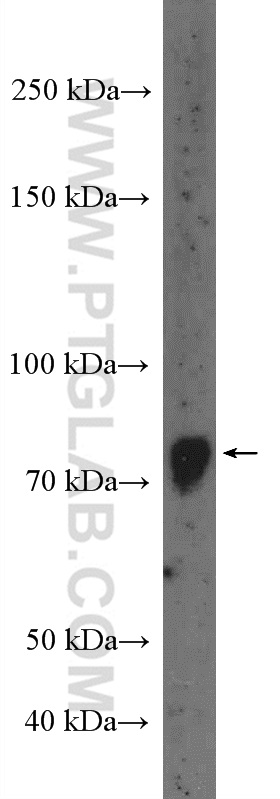 WB analysis of mouse kidney using 12678-1-AP