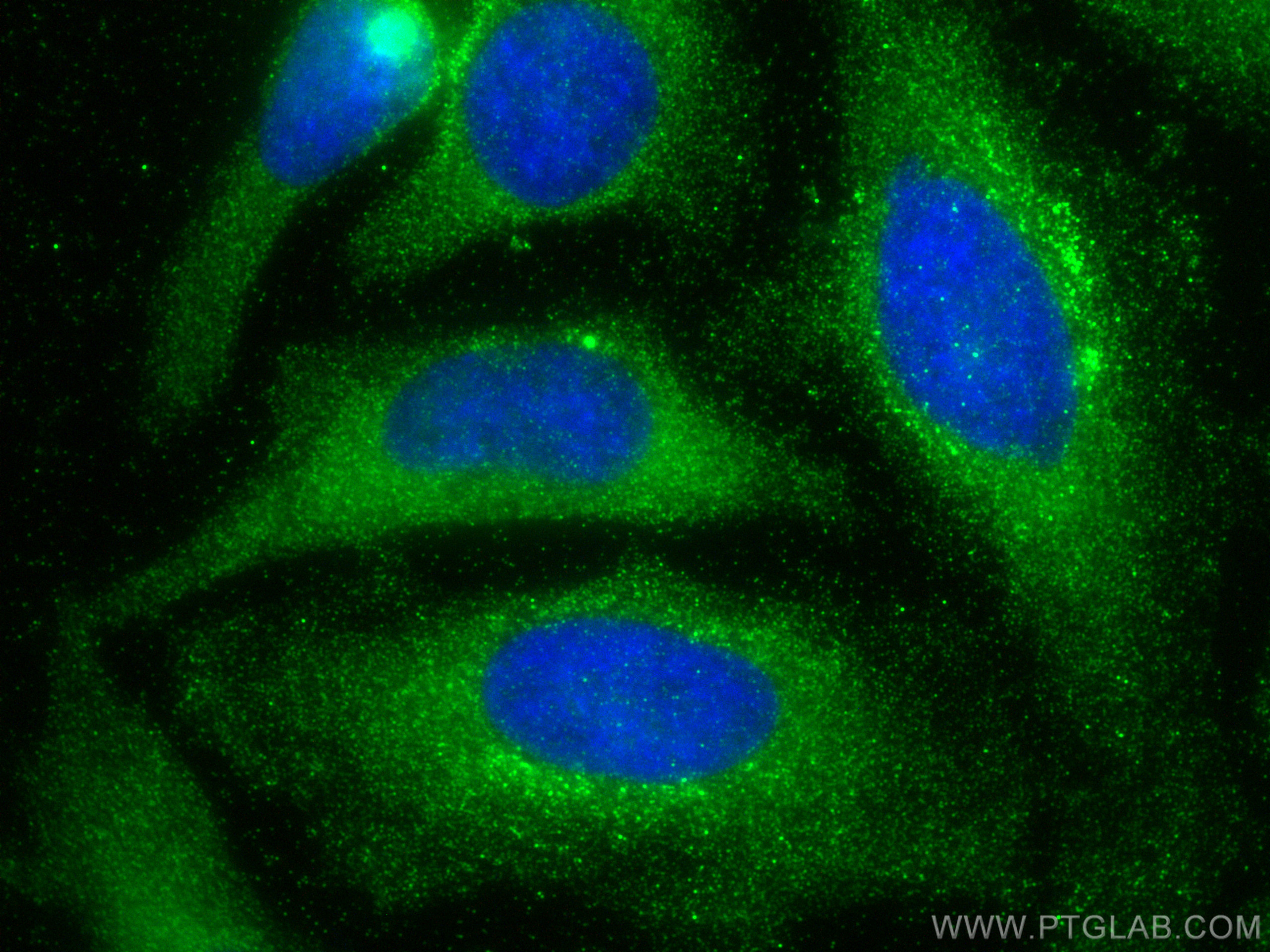 IF Staining of HeLa using 68242-1-Ig (same clone as 68242-1-PBS)