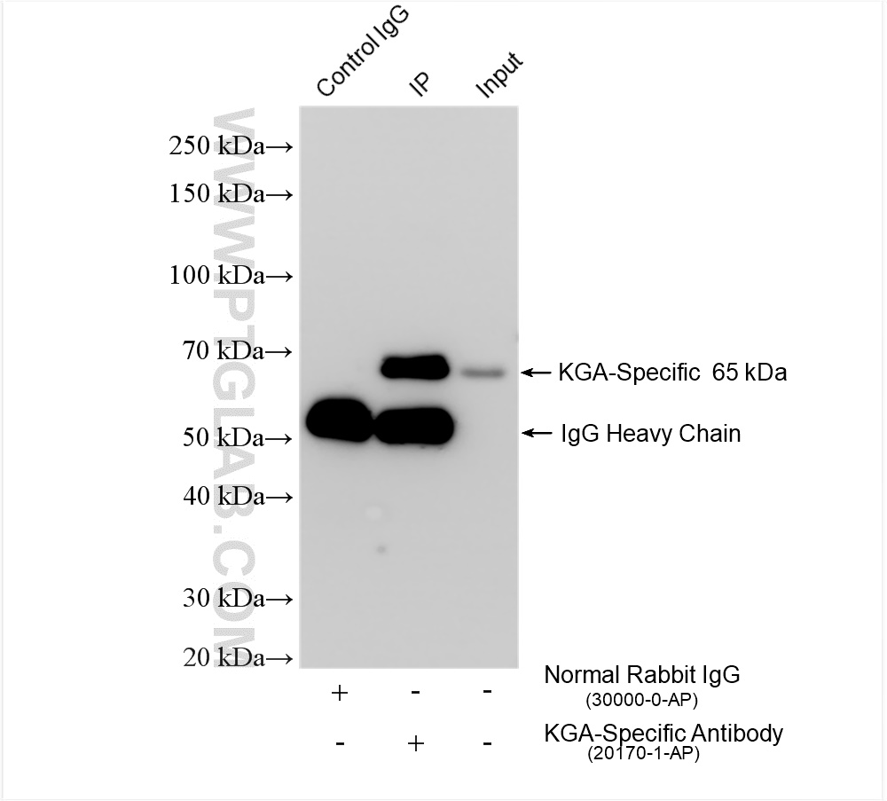 IP experiment of HEK-293 using 20170-1-AP