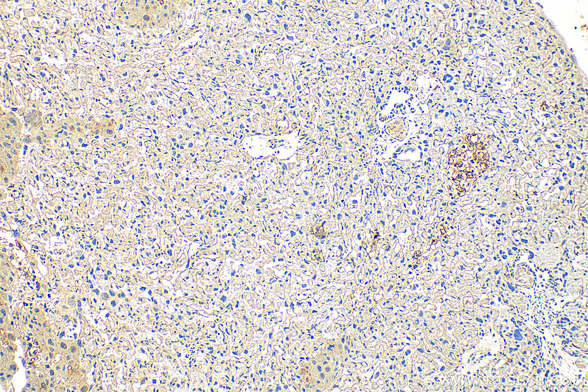 IHC staining of mouse placenta using 16768-1-AP