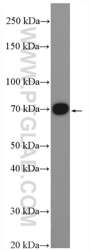 WB analysis of SH-SY5Y using 16768-1-AP