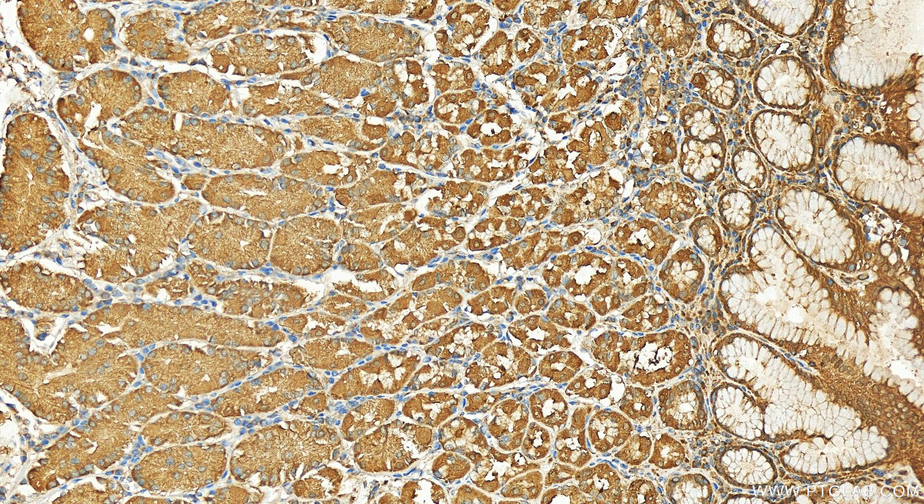 IHC staining of human stomach using 10850-1-AP