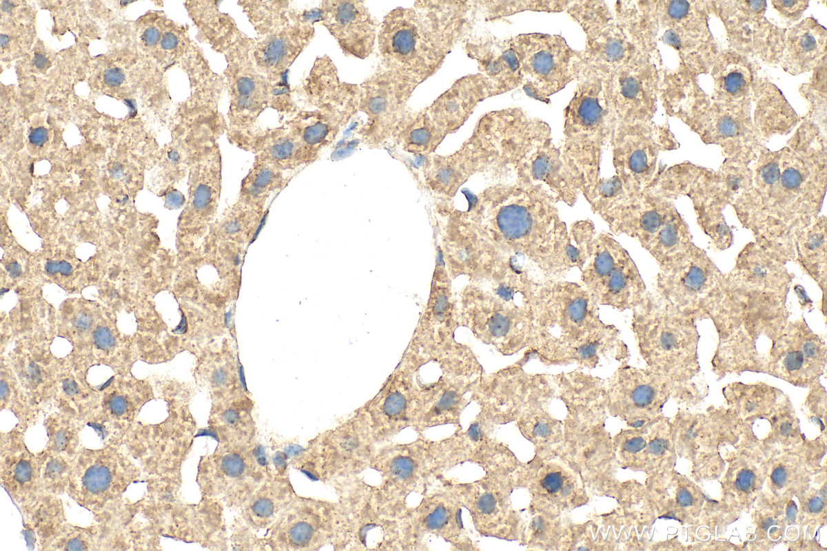 IHC staining of mouse liver using 14299-1-AP