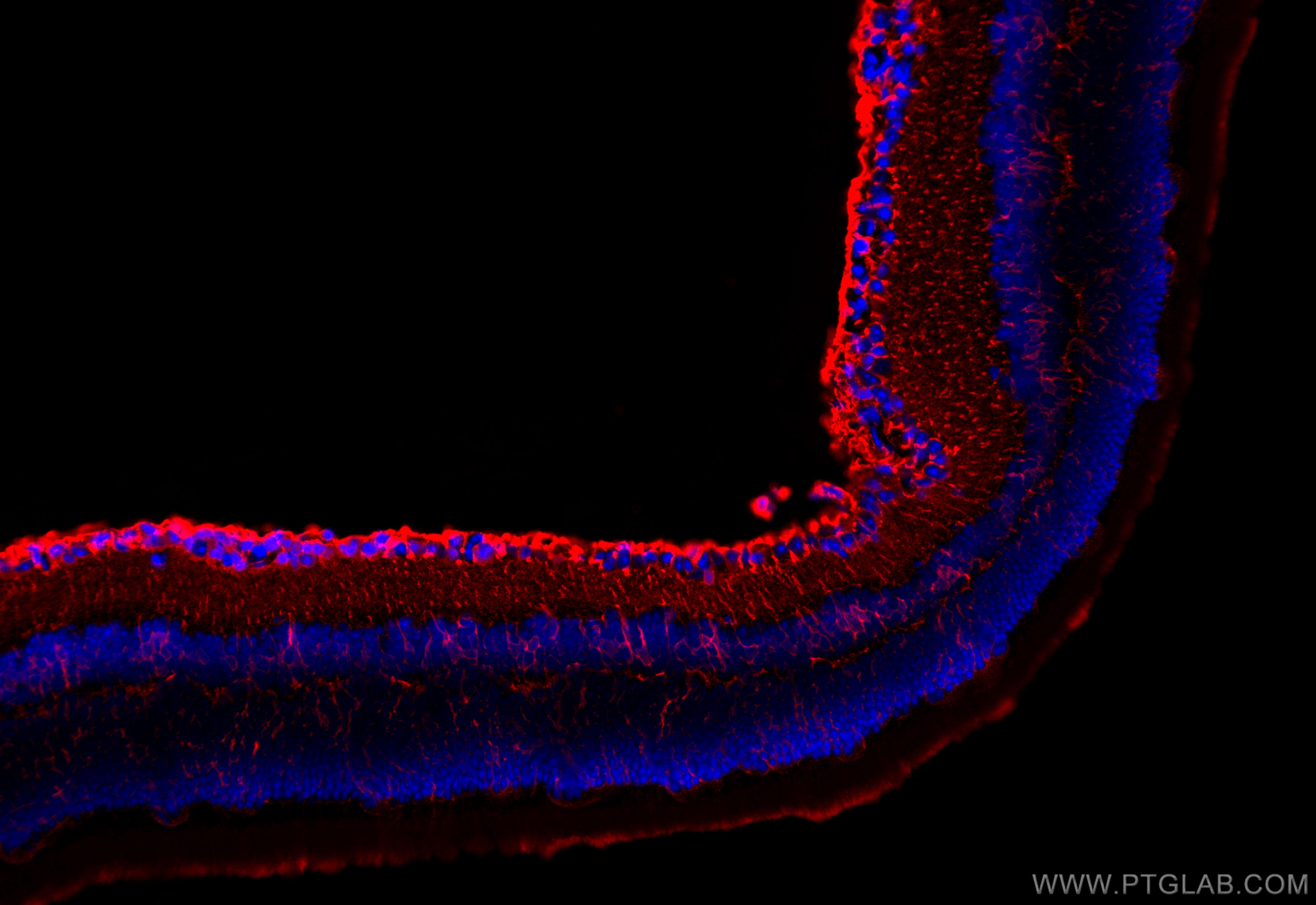 IF Staining of mouse eye using 11037-2-AP