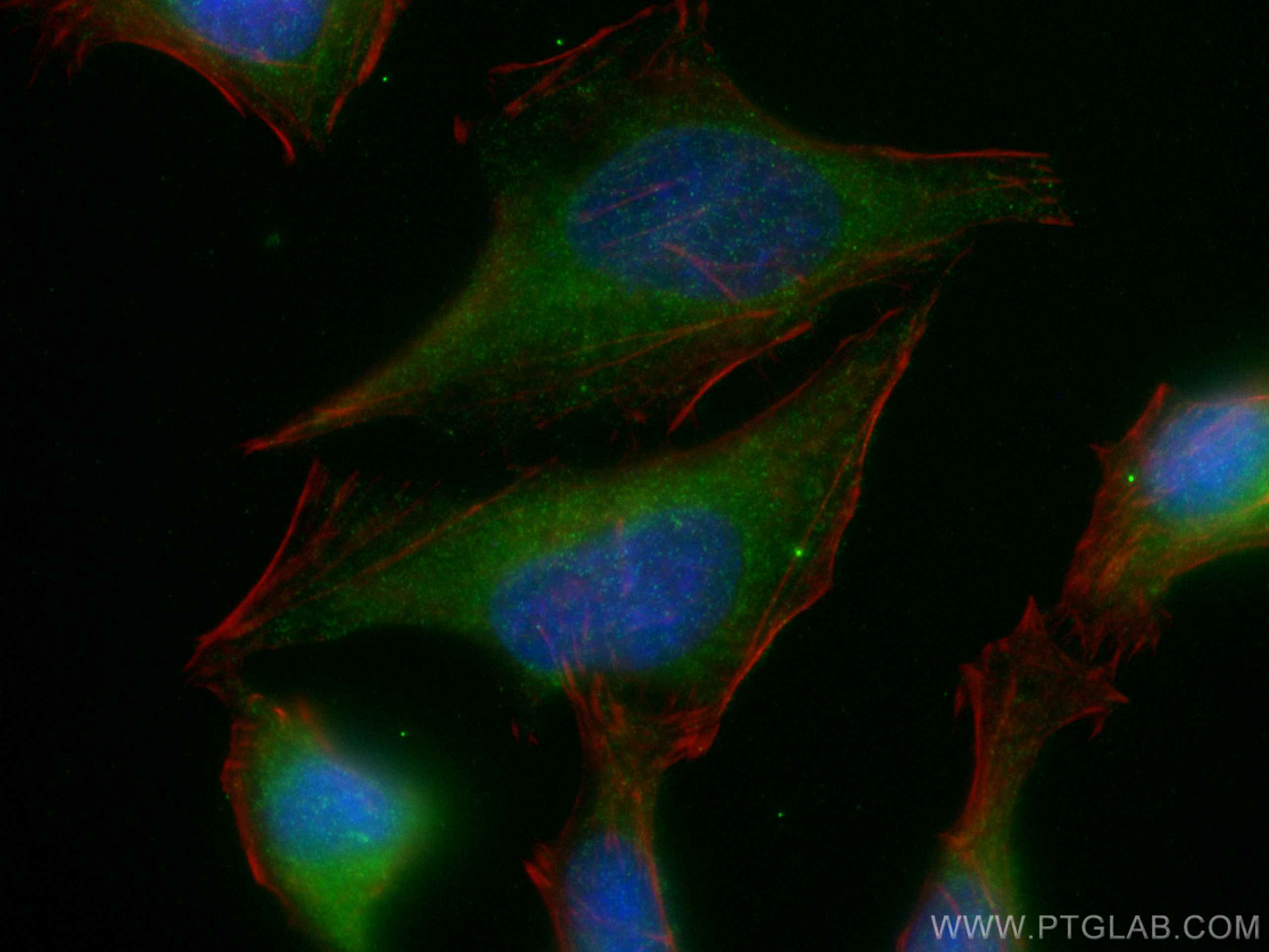 IF Staining of HeLa using 12426-1-AP